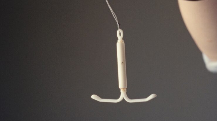 DIU hormonal e risco de câncer de mama: o que sabemos até agora