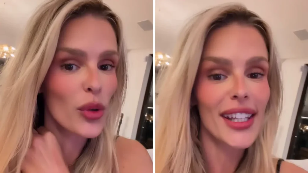 Yasmin Brunet revela que descobriu lipedema de forma inusitada
