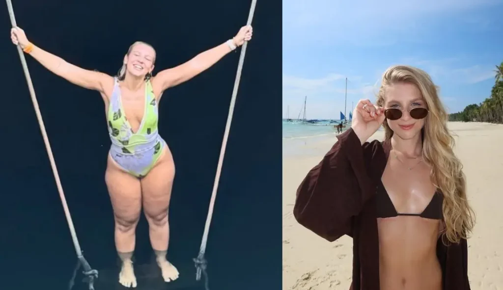 Lauren Pfeiff relata um ano de cirurgia de lipedema: sua transformação