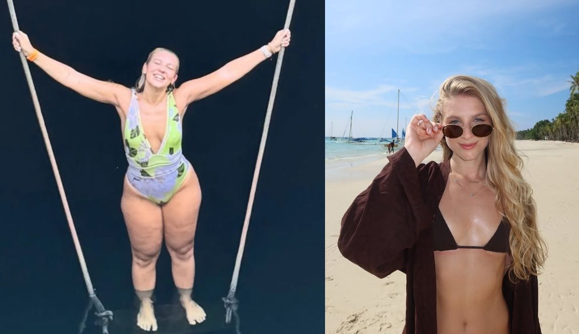 Lauren Pfeiff relata um ano de cirurgia de lipedema: sua transformação